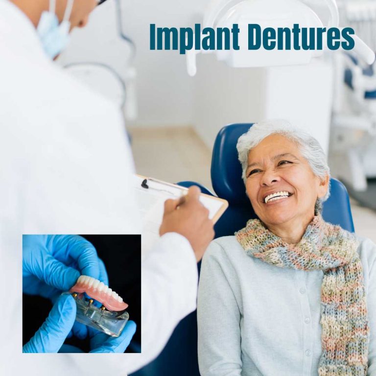 The 7 Most Asked Questions When People Consider Implant Dentures