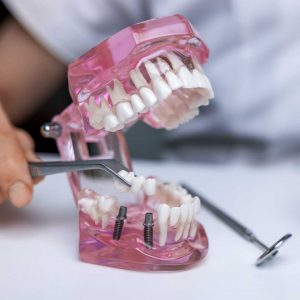 calgary denture referral free repair