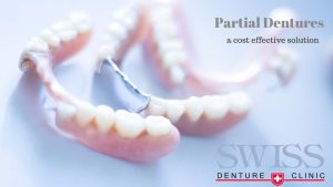 calgary-partial-denture