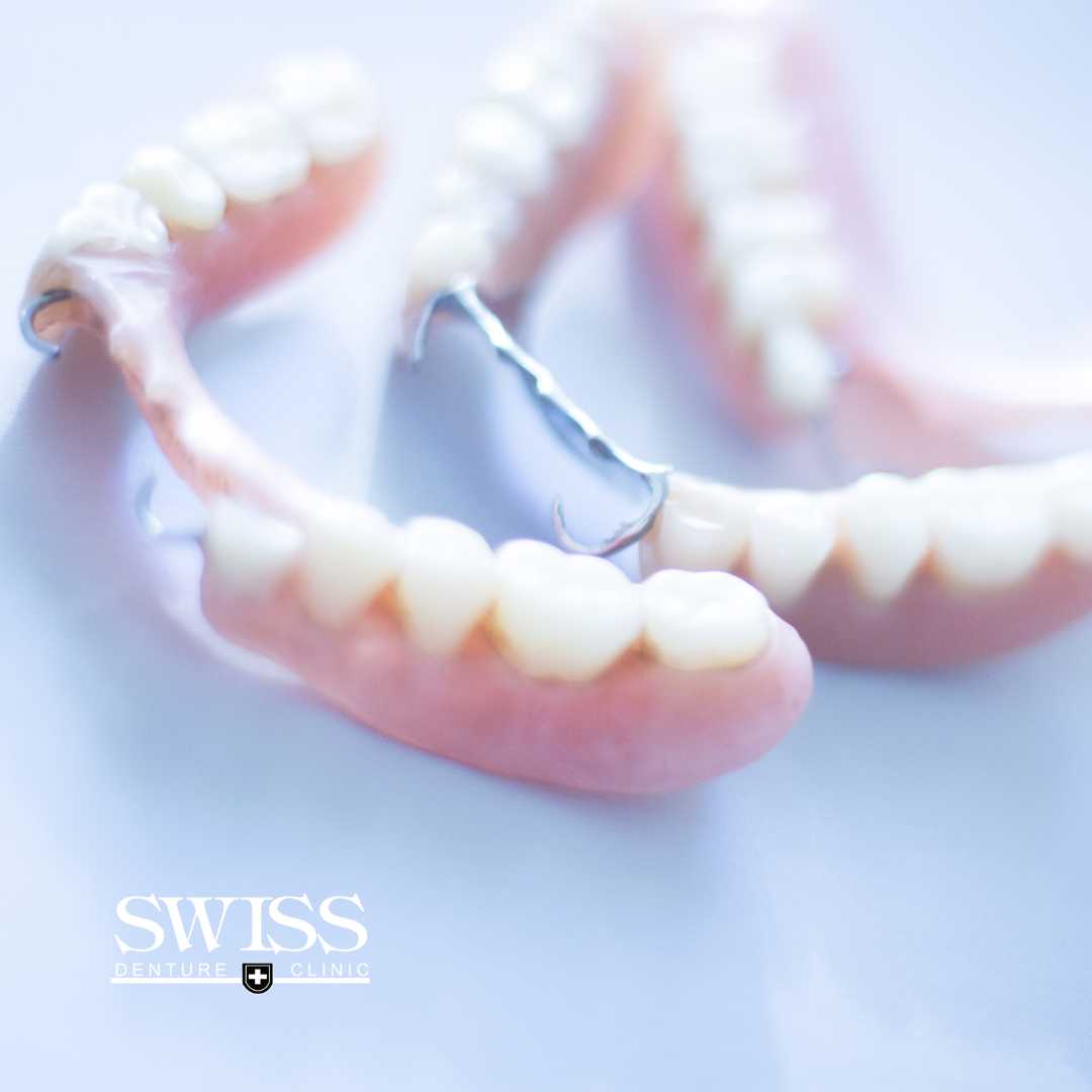 partial-dentures-calgary-swiss-denture